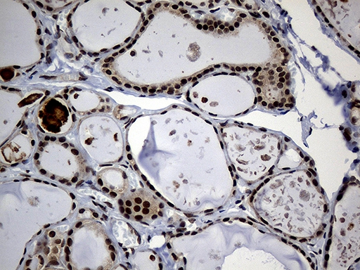 IHC 检测